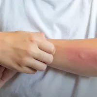 GÜNDEM