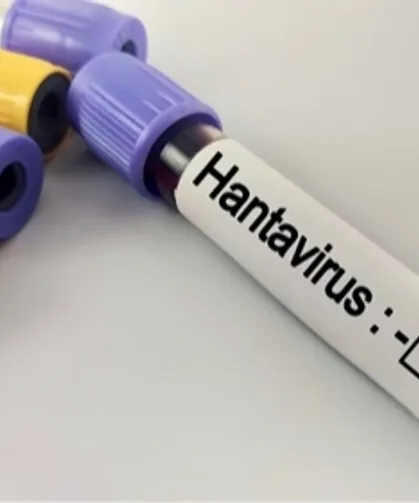 Hantavirüs salgına dönüşür mü? Kapalı alan temizliğinde büyük risk