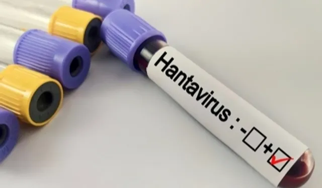 Hantavirüs salgına dönüşür mü? Kapalı alan temizliğinde büyük risk